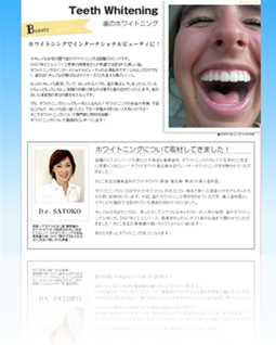 歯のホワイトニング 体験取材