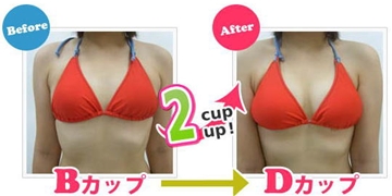 b-upガールズ