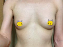 image001,バストアップ法体験談,貧乳改善法,育乳法,バストを大きくする方法