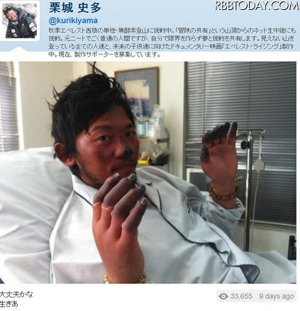 登山家・栗城史多さん、指数本を切断へ……エベレスト挑戦の重すぎる代償 : 結婚＆離婚のあれこれ まとめ