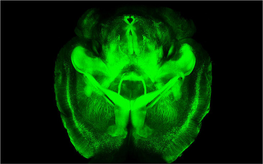 CLARITY_brain