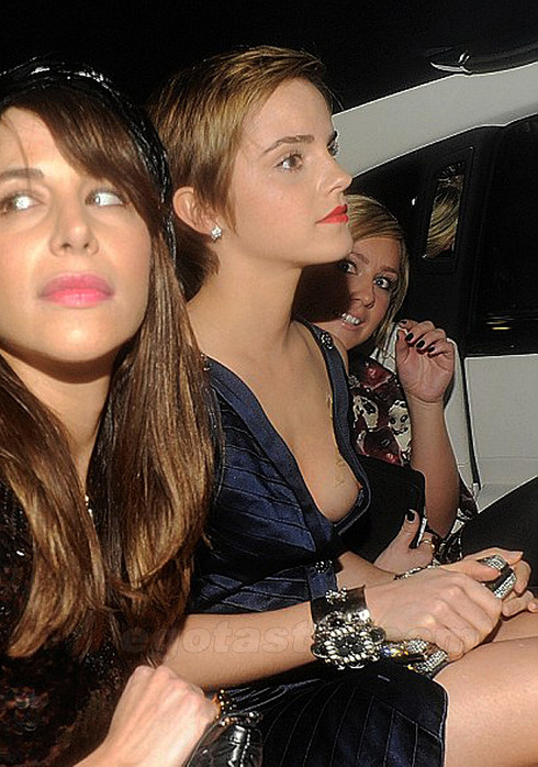 emma-watson-pre-bafta-malfunctions-01
