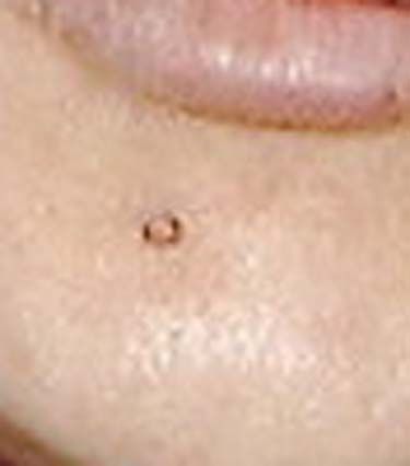 lloh827_1