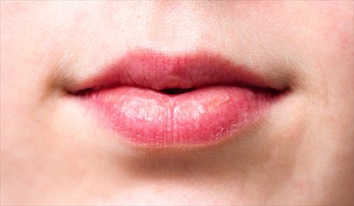 最近唇にすぐ口内炎ができるんやが