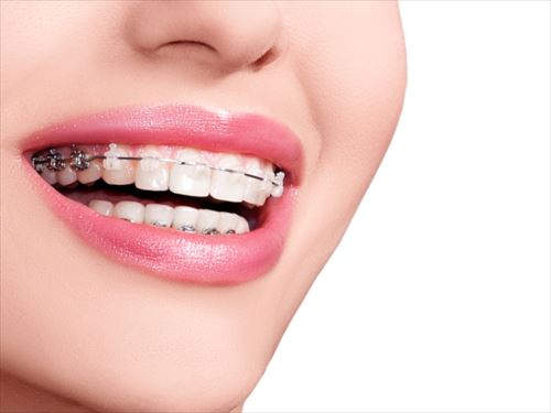 orthodontics_1_R