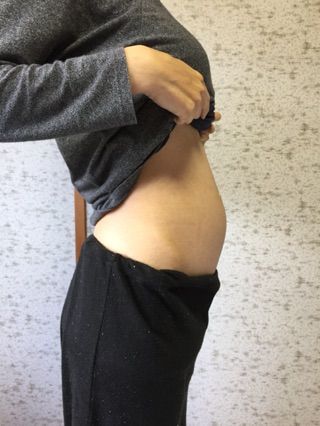 妊娠 19 週