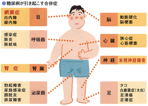 img_diabetes04