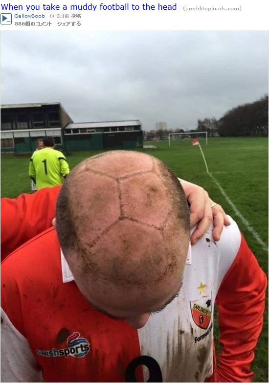 ハゲサッカー画像選手ヘディングヅラカツラ