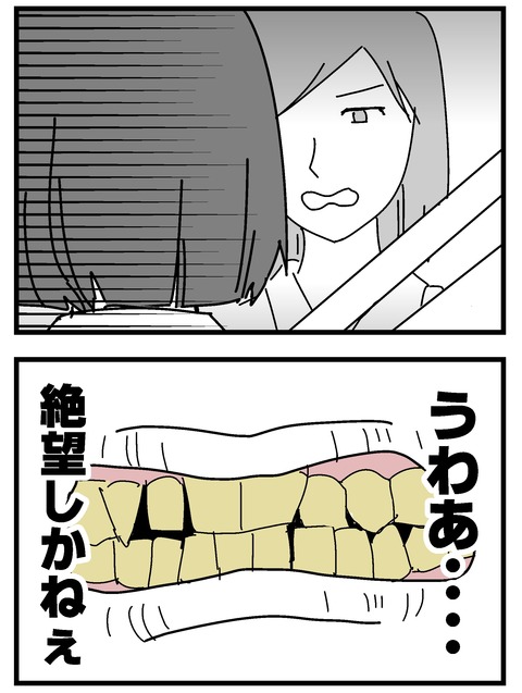 歯1