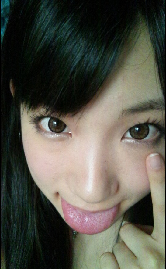 VgXT4