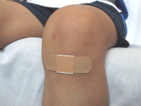wound-106374_1920