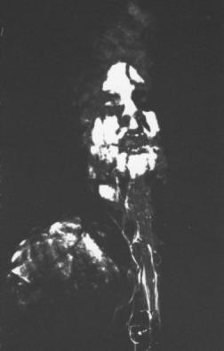 onlydeath