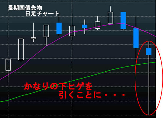 ?日足債券