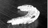 OA