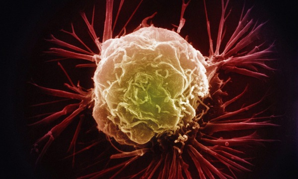 がん細胞２