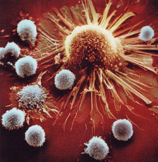 がん細胞を攻撃するキラーT