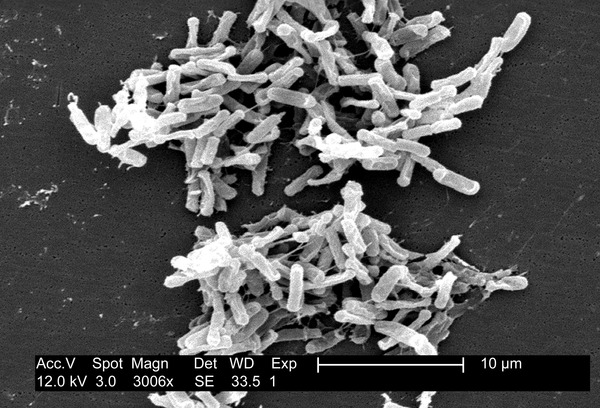 Clostridium_difficile_01