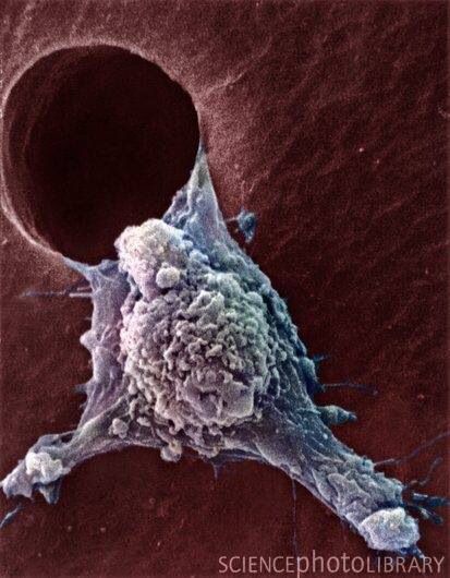がん細胞