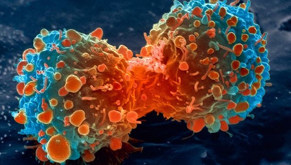 がん細胞３