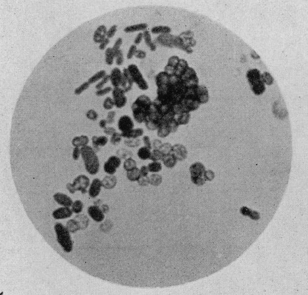 Azotobacter_cells