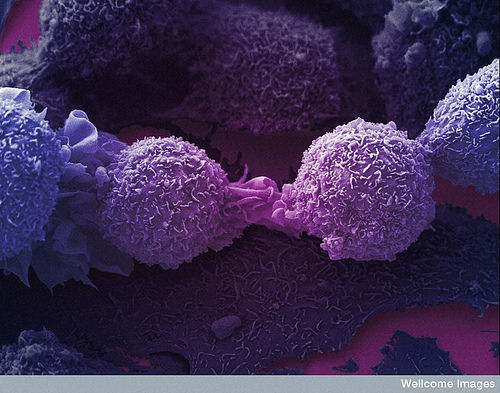 がん細胞７