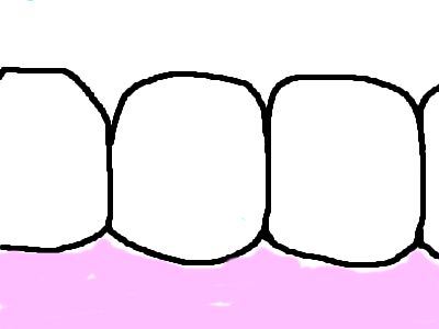 歯ブラシ1