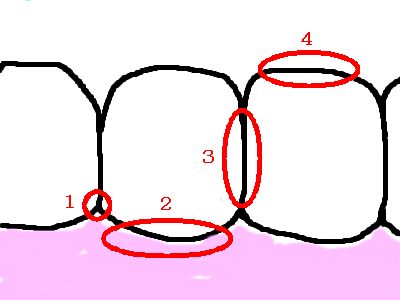 歯ブラシ2