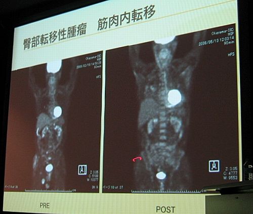 �������缣����13