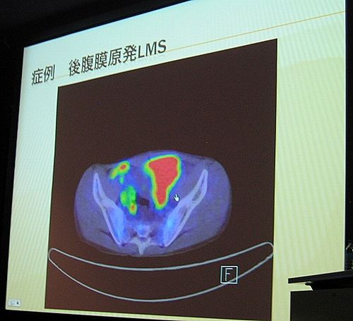�������缣����28