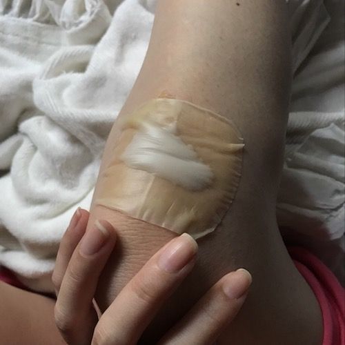 膝小僧