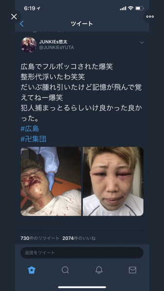 【画像あり】北九州のヤンキー2人組(24)、広島の番長(19)に二人まとめて半殺しにされてしまうwwwww