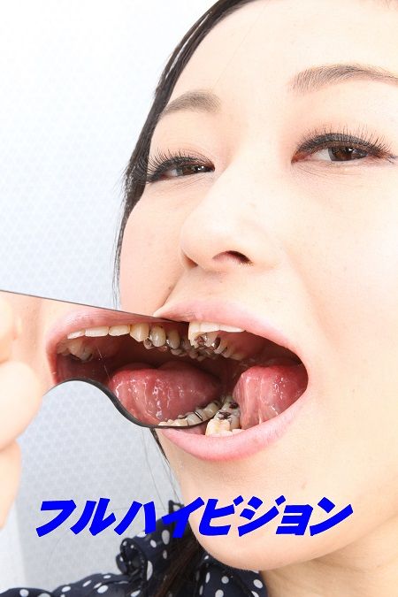 いちはFHD