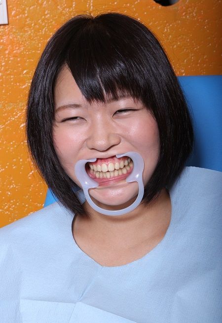 いい歯の日_2 (1)