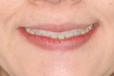 20110629d