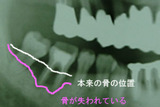 BlogPaint