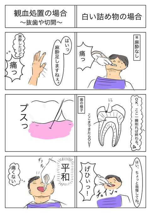歯科あるある2