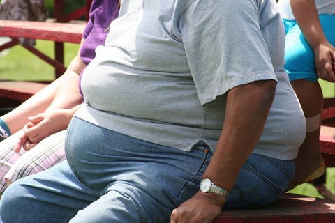 Obesity 00
