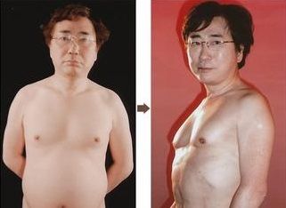 高須2