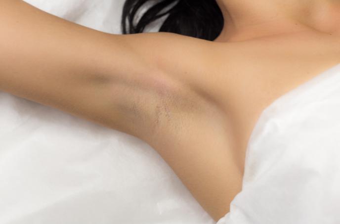 医師に聞いた!脱毛することのメリット・デメリット