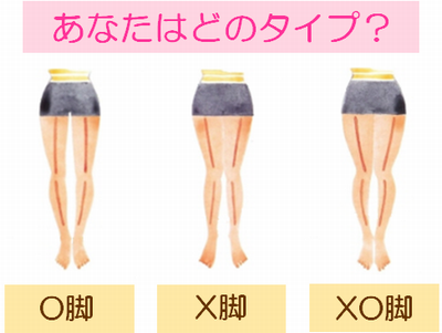 脚歪み