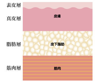 たるんだ皮膚の画像【一生治らない】
