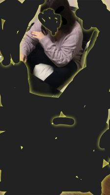 178