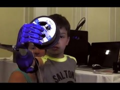 3Dプリンター義手