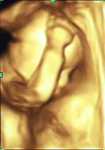 baby20060826001b_1.jpg