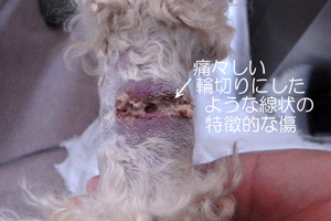 輪ゴムによる傷