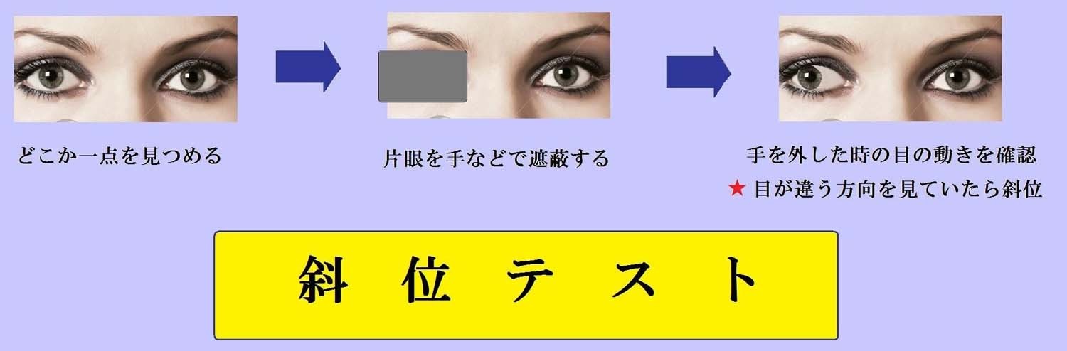 斜視