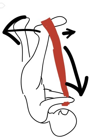 O脚矯正