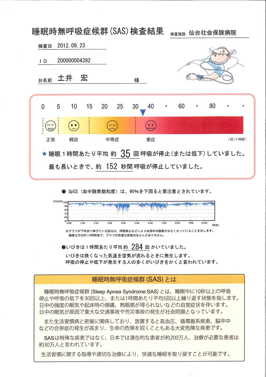 無呼吸