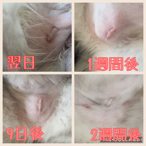 避妊手術痕