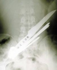 images